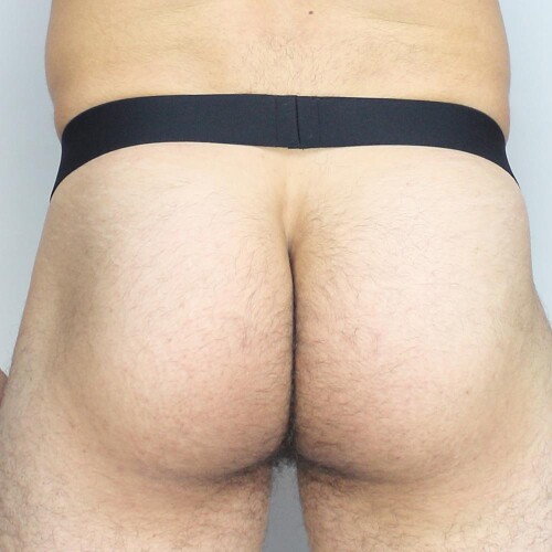 mckillop-mppl-max-bulge-pouch-expose-black-A1.jpeg