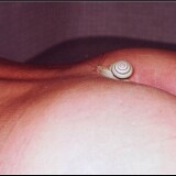 Scan10100