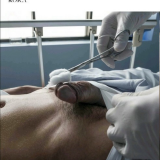 ThePatient-082