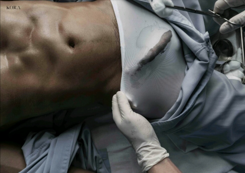 ThePatient-092.png